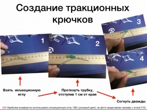 Ранорасширитель циркулярный Звезда